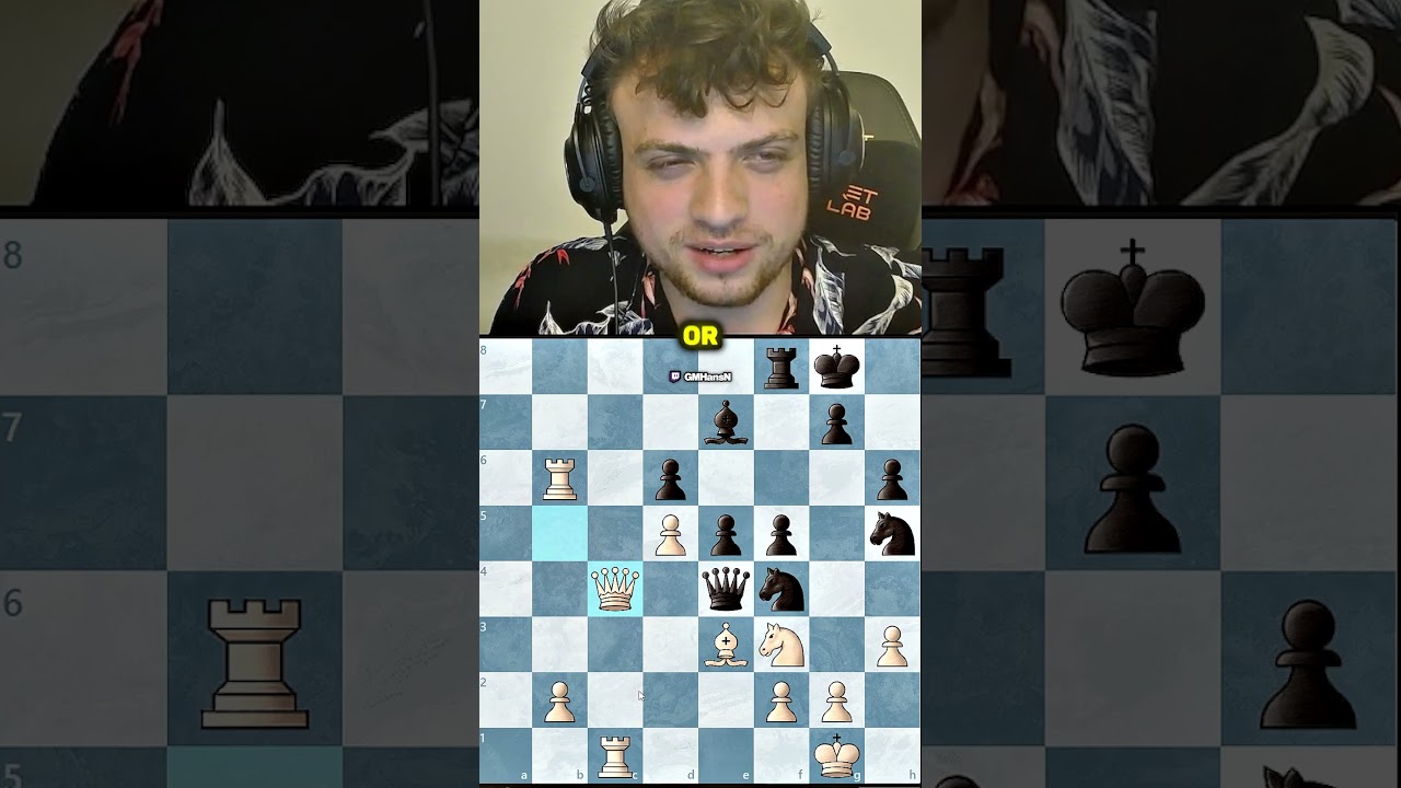 Reddit Is For Losers